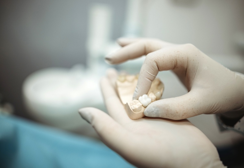 Tooth Replacement Service in St. Charles, MO