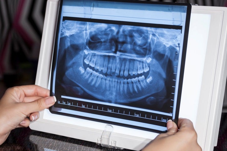 Dental X-Rays in St. Charles, MO
