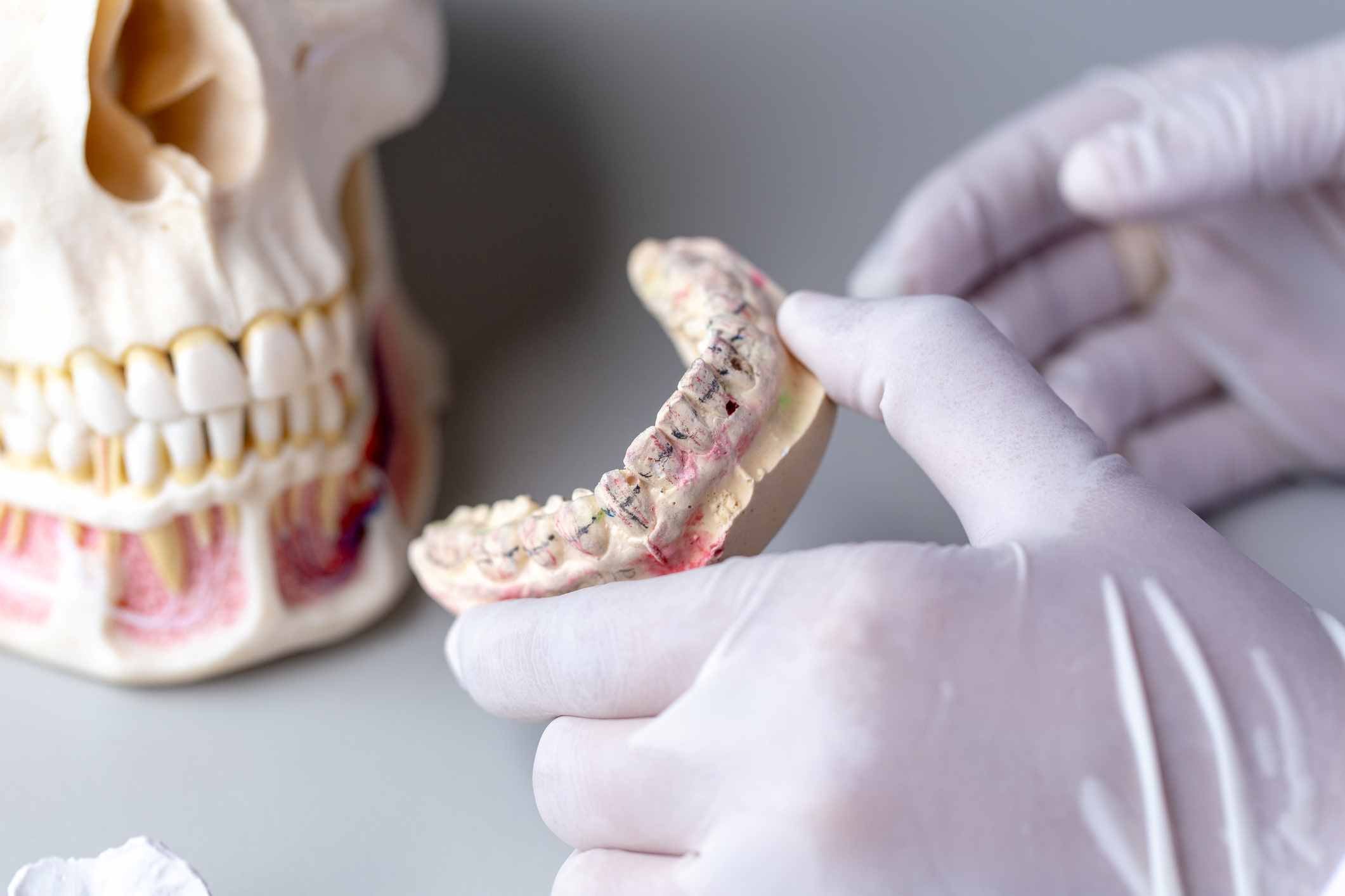 Dental Crowns and Bridges in St. Charles, MO