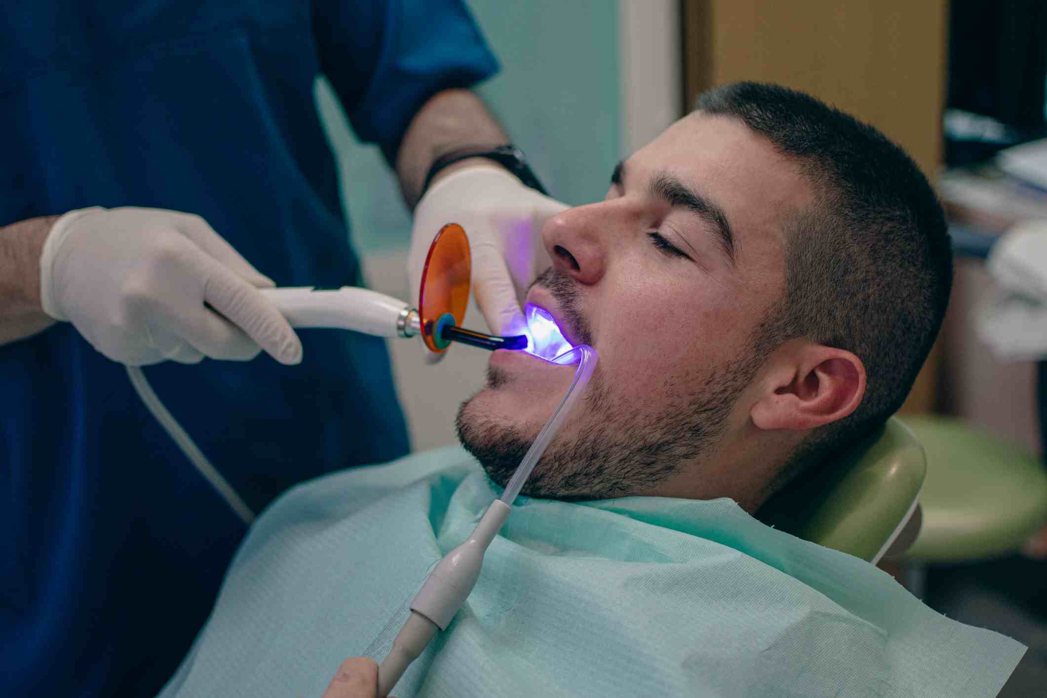 Composite Dental Fillings treatment in St. Charles, MO